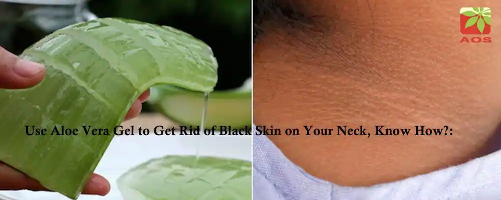 Aloe Vera Gel for Black Neck
