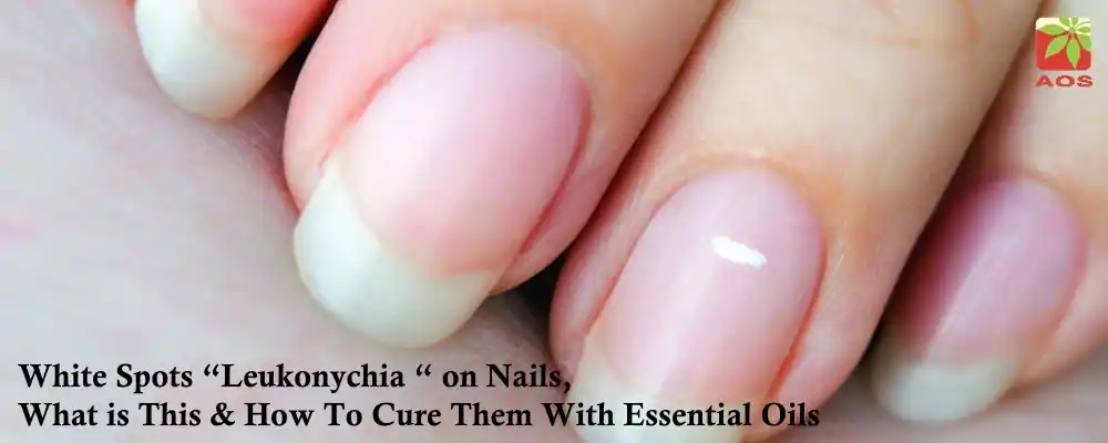 What Essential Oil Cures White spots on Nails