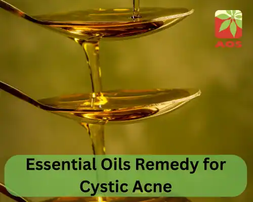 Essential Oils Remedy for Cystic Acne